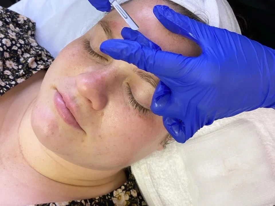 Belleville facial peel being applied to customer