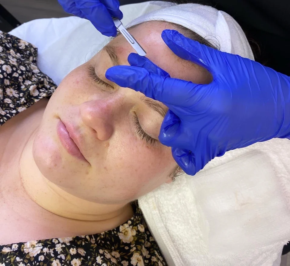 Belleville facial peel being applied to customer