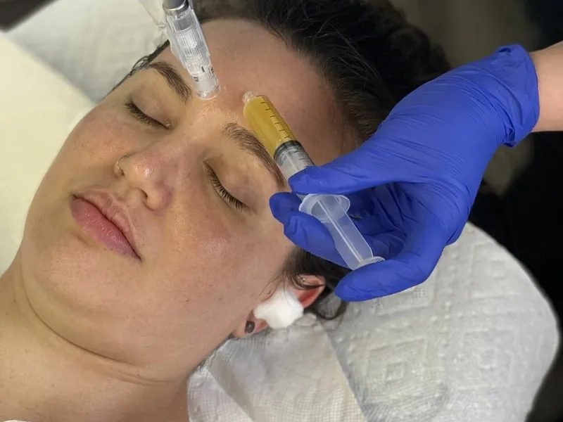 Woman undergoing PRP injection facial procedure to stimulate collagen and rejuvenate skin in Belleville