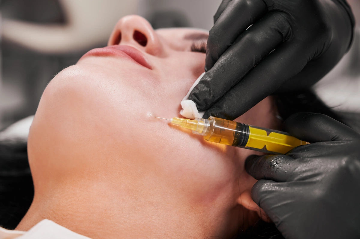 PRP Injection in a woman's chin in Belleville